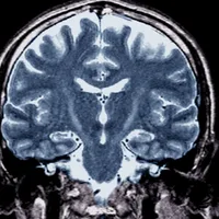 Opinion: I have a genetic mutation linked to ALS. The Trump administration terrifies me