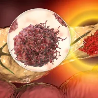 New blood test could catch pancreatic cancer before it’s too late